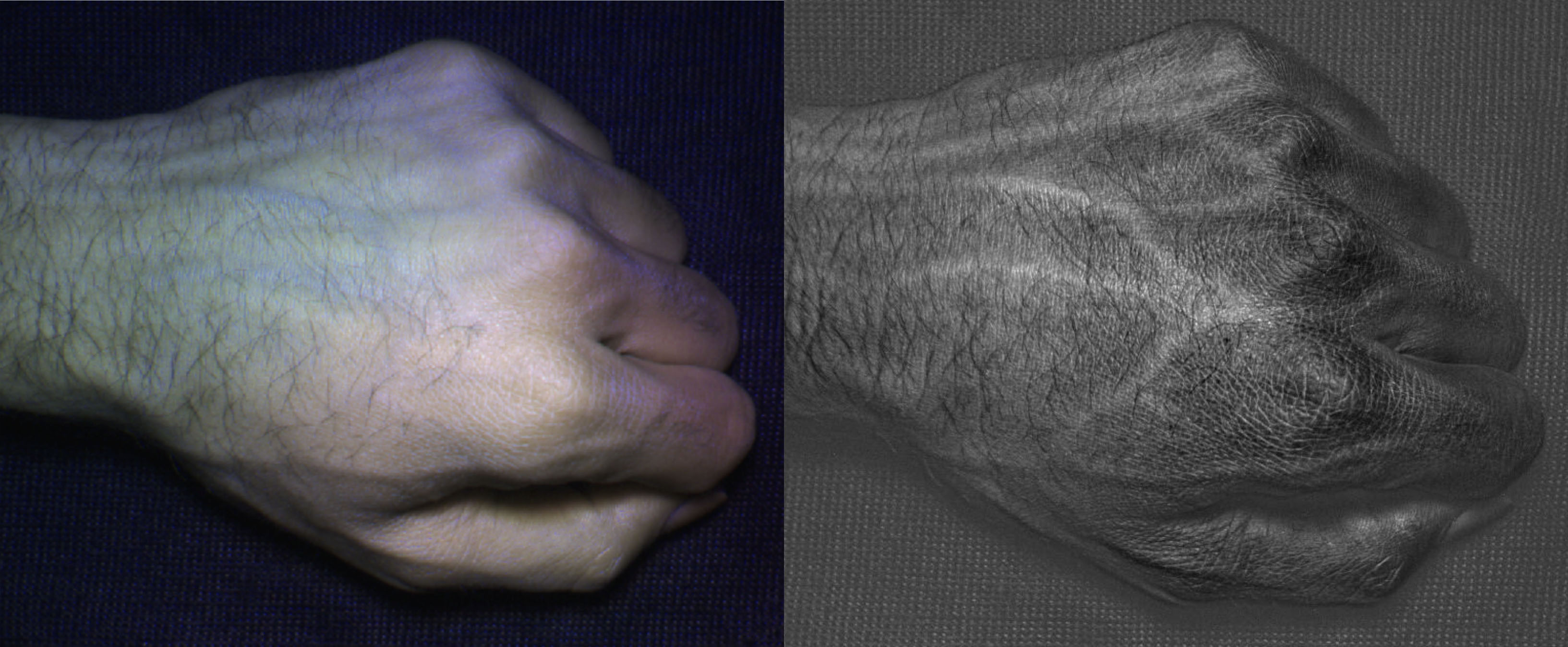 HyperCam images (right) reveal detailed vein and skin texture patterns that are unique to each individual